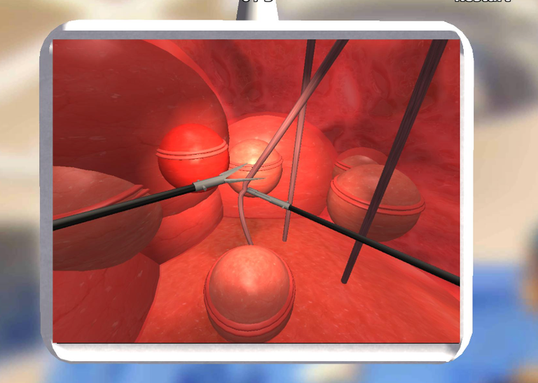 Laparoscopy game 3D art